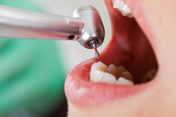 Best Emergency Treatment for Toothache in Martinsburg, PA